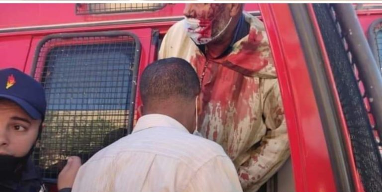 مغرب تايمز - "الدق والتفرشيخ" يرسل منتخبين إلى مستشفى الحسن التاني