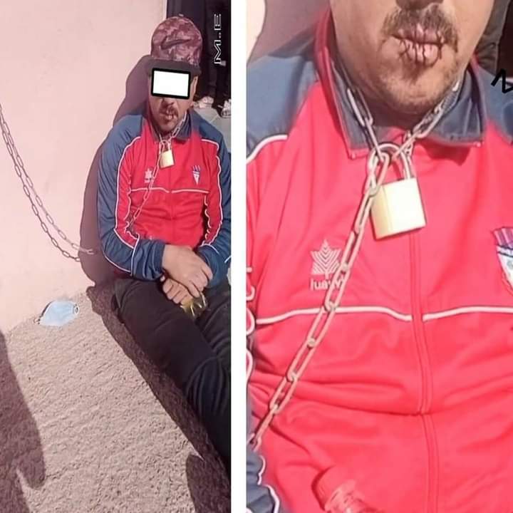 مغرب تايمز - مواطن يخيط فمه إحتجاجا على خدمة إدارية قرب جماعة سيدي بيبي