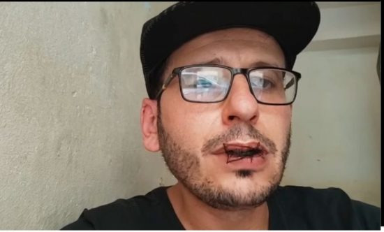 مغرب تايمز - ناشط"حراك الريف" الأبلق يهدد بحرق نفسه بعد إدانته بأربع سنوات