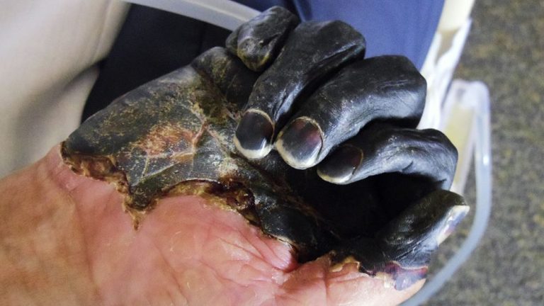 مغرب تايمز - الصين تسجل أول إصابة بـ”الموت الأسود”